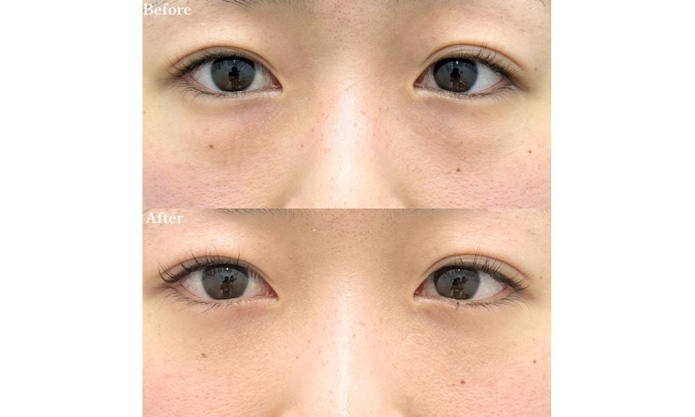 20代 裏ハムラ