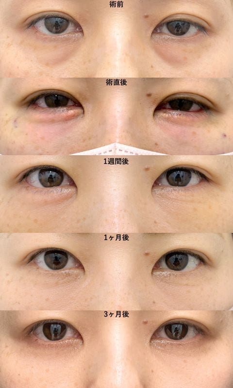 ダウンタイム