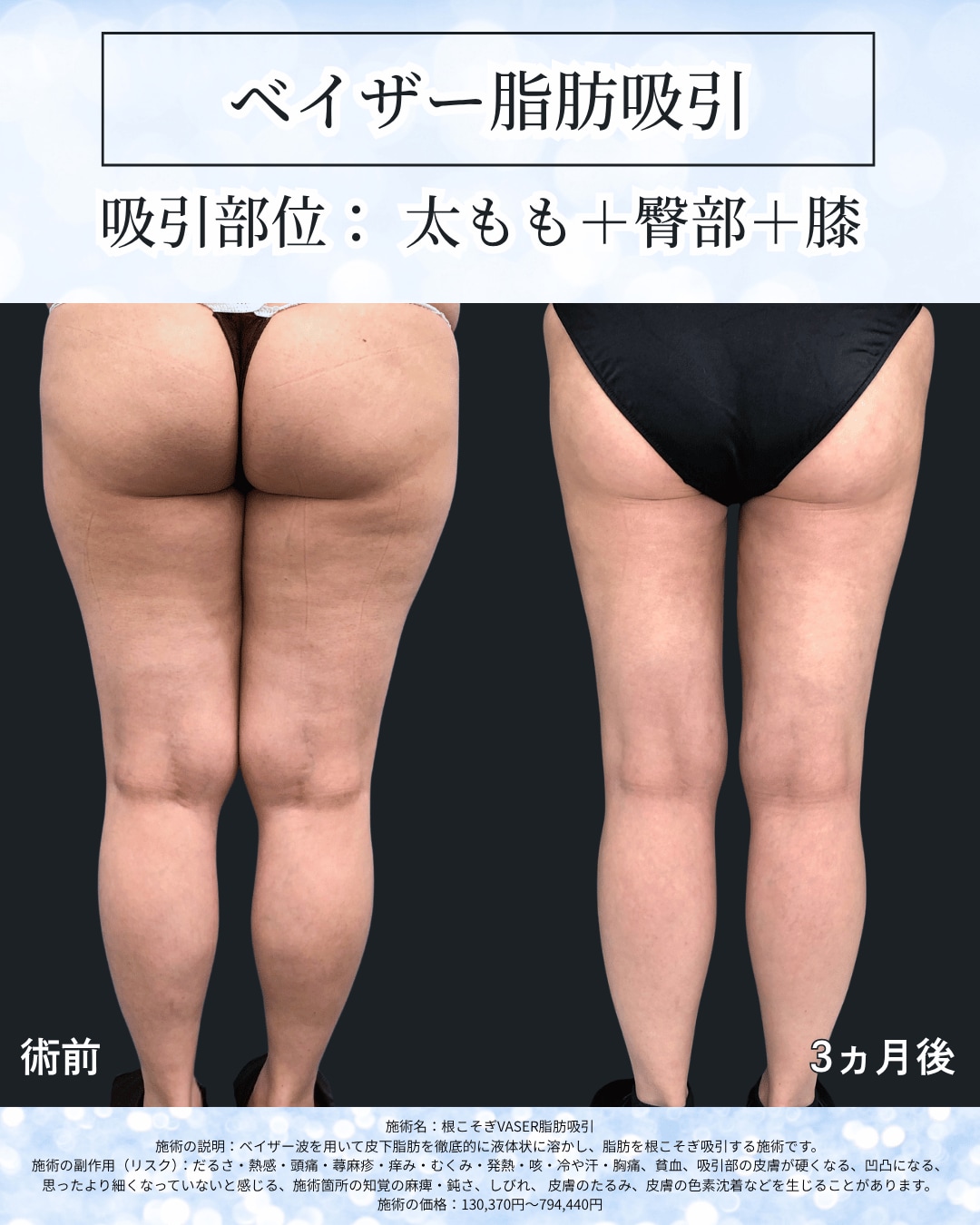 症例でわかる“自然で美しい仕上がり”をご紹介！
