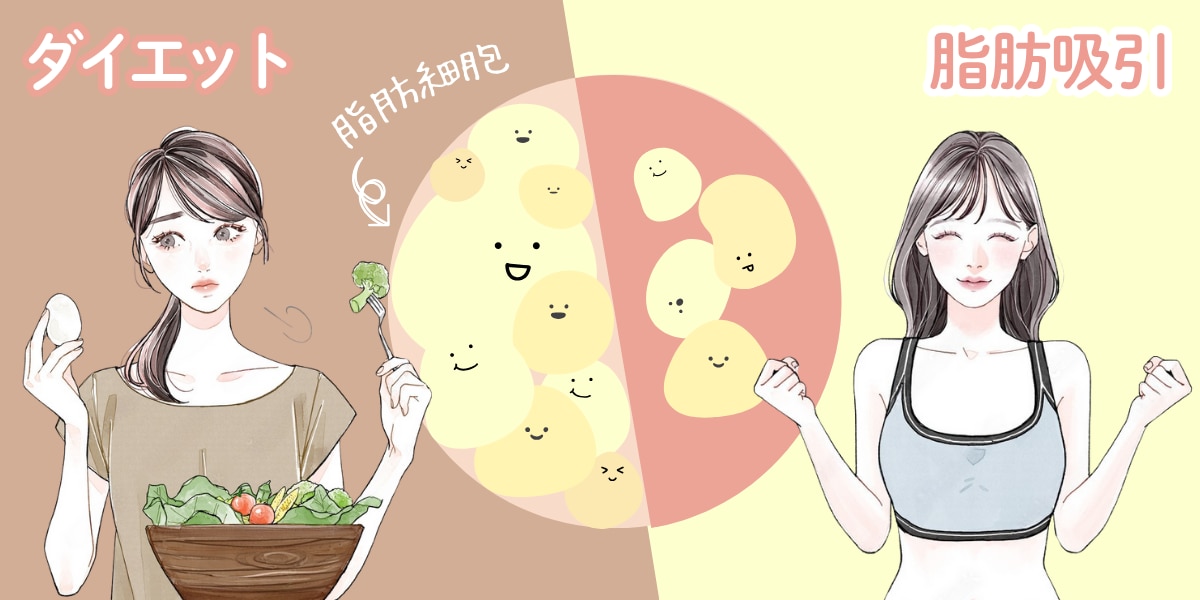 脂肪吸引はリバウンドしづらい！ダイエットとは根本的に違うんです！