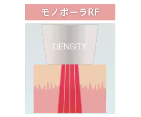 ①深部から引き締める「モノポーラRF」