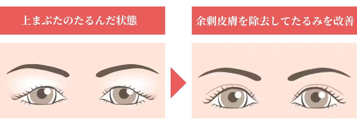 鏡を見るたびに、あれ?目が重い…そんな時ありますか?