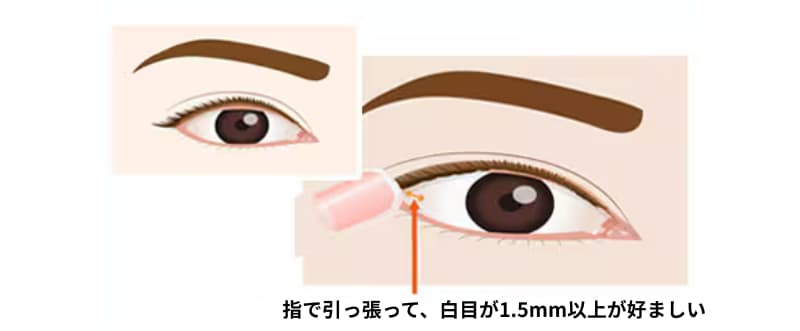 目尻切開が適している方