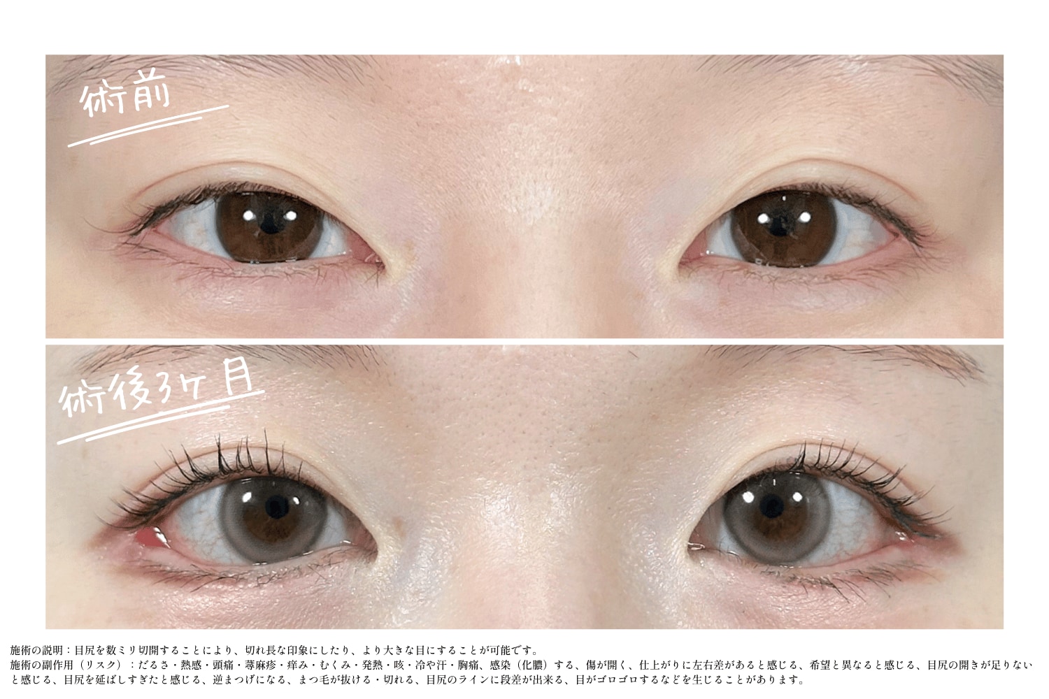 二重+αの可愛さ♡<br />