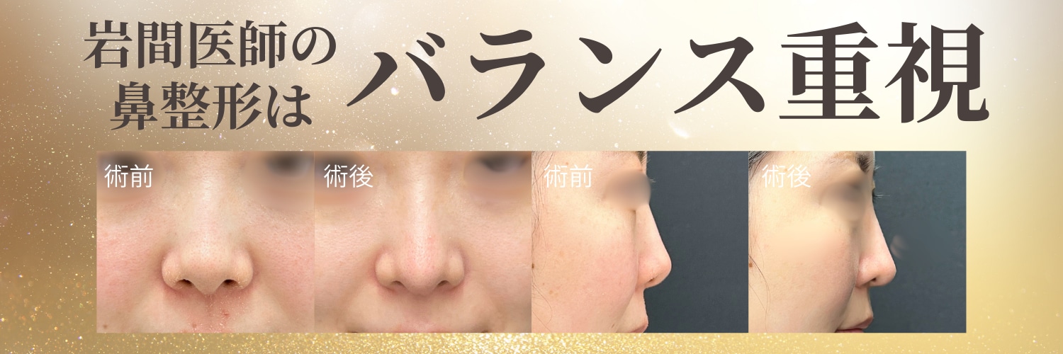 「やりすぎない鼻整形」で一生モノの美しさ