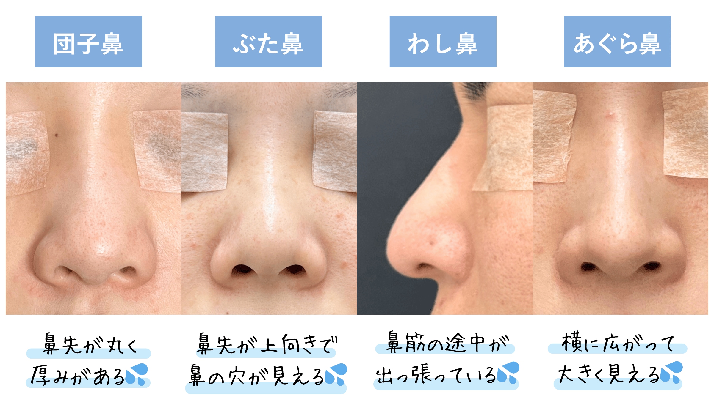 コンプレックスに終止符を！