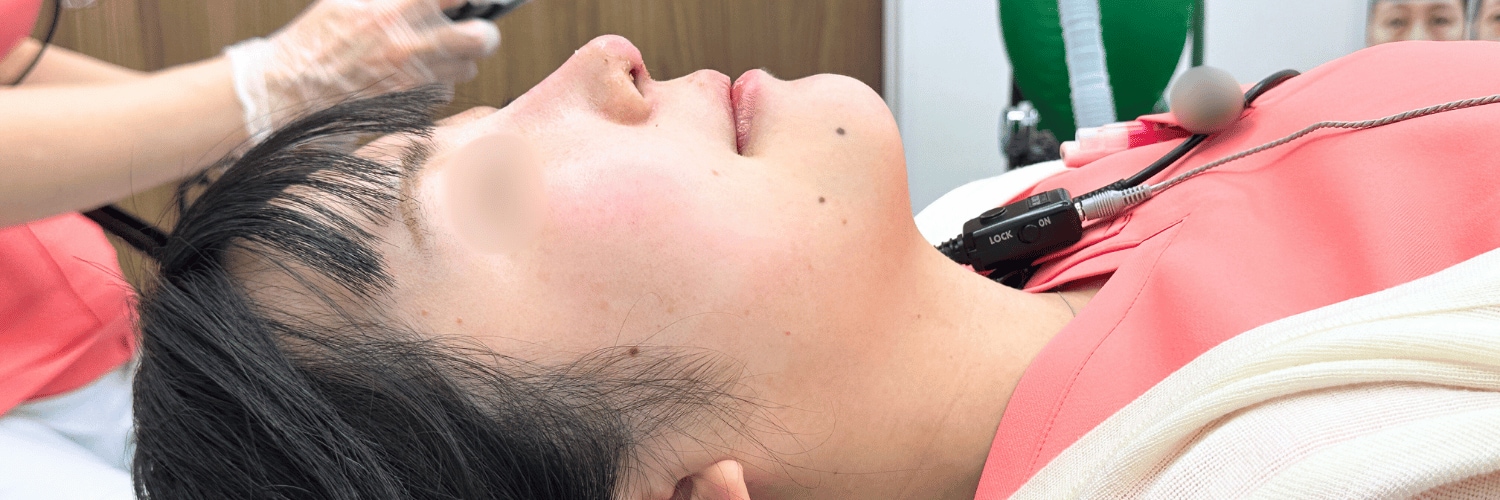 1週間後（抜糸後）でもこんなに綺麗な仕上がり