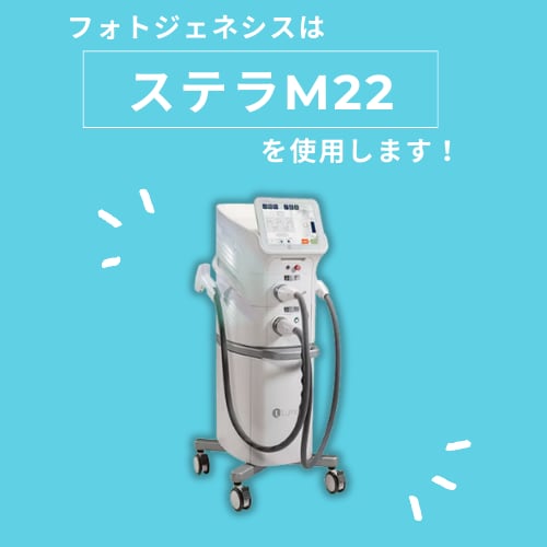 ステラM 22とは？