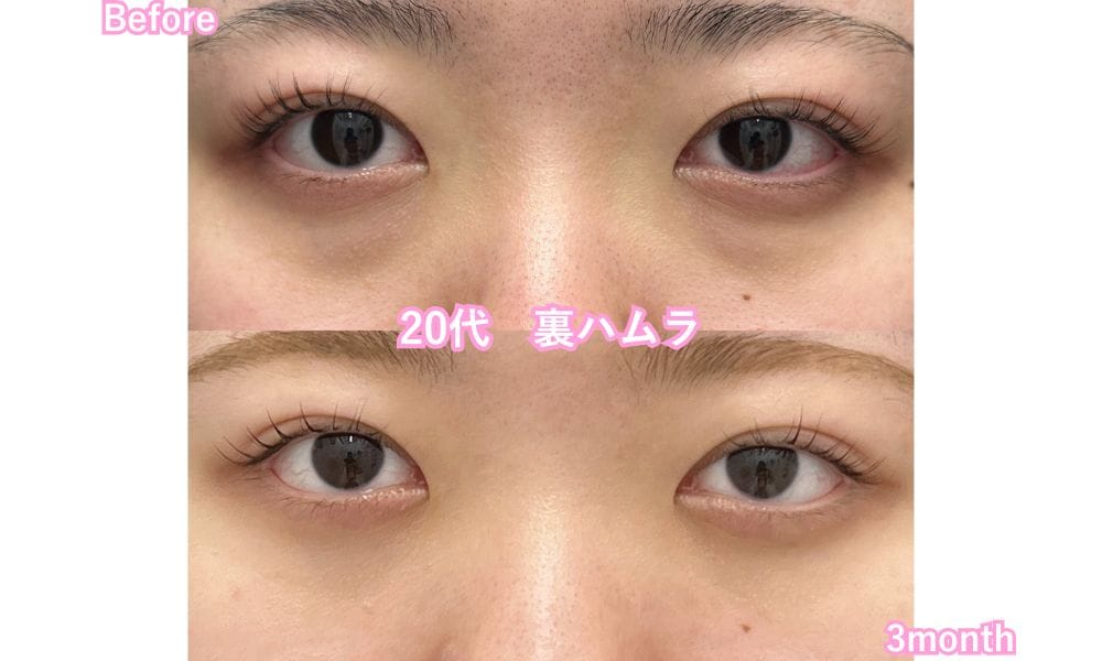 最新版はこちら