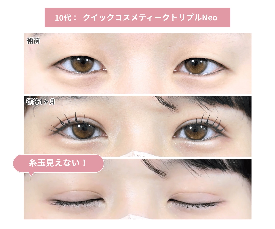 全て岩間医師が執刀した症例です！