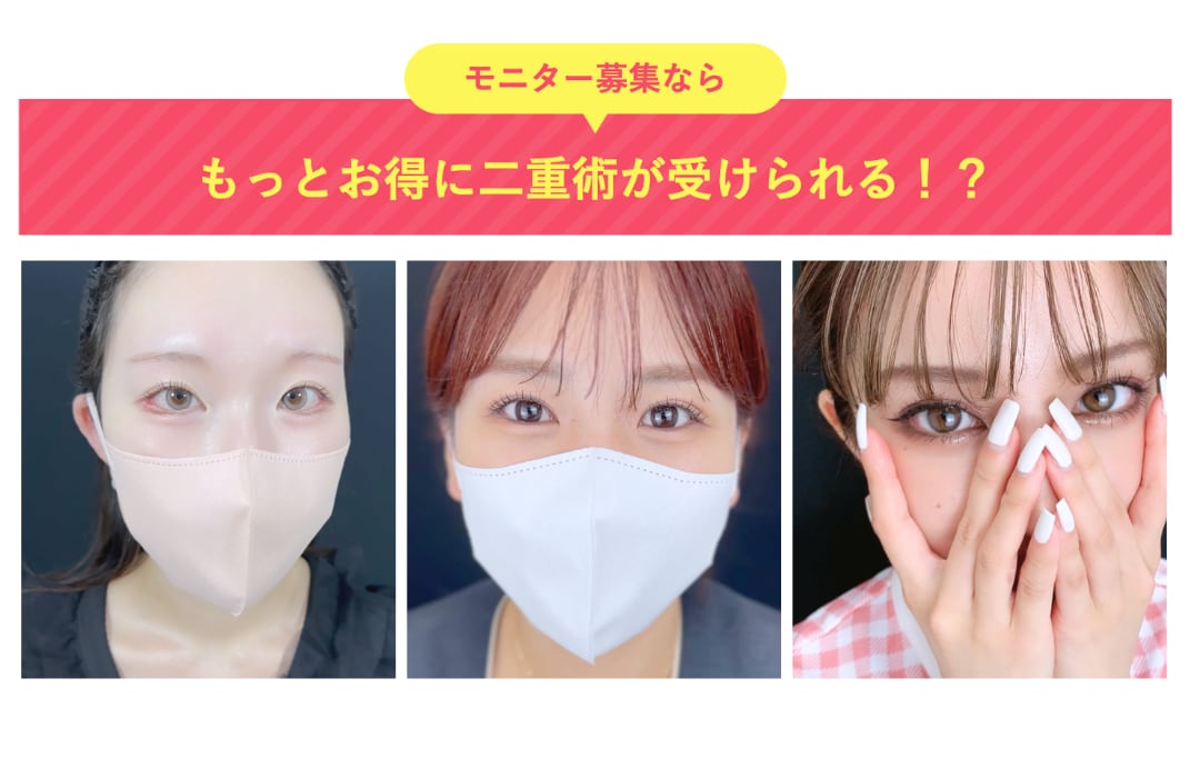 もっとお得に二重術が受けられる！？