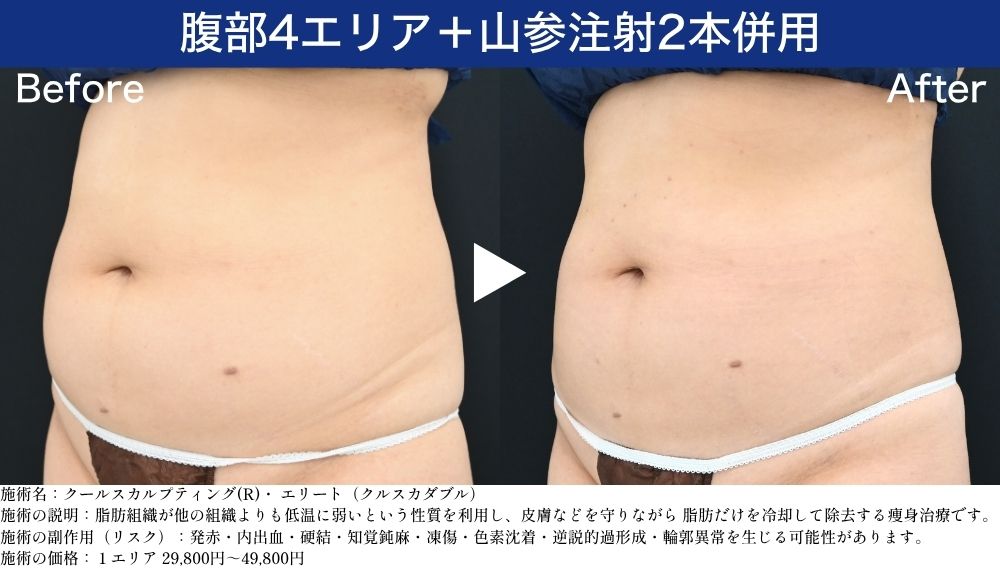 腹部