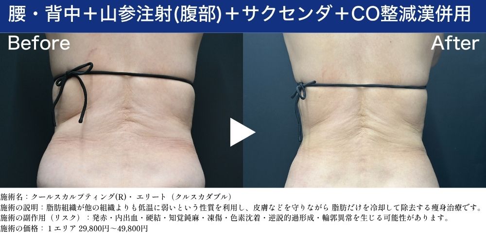 腰・背中