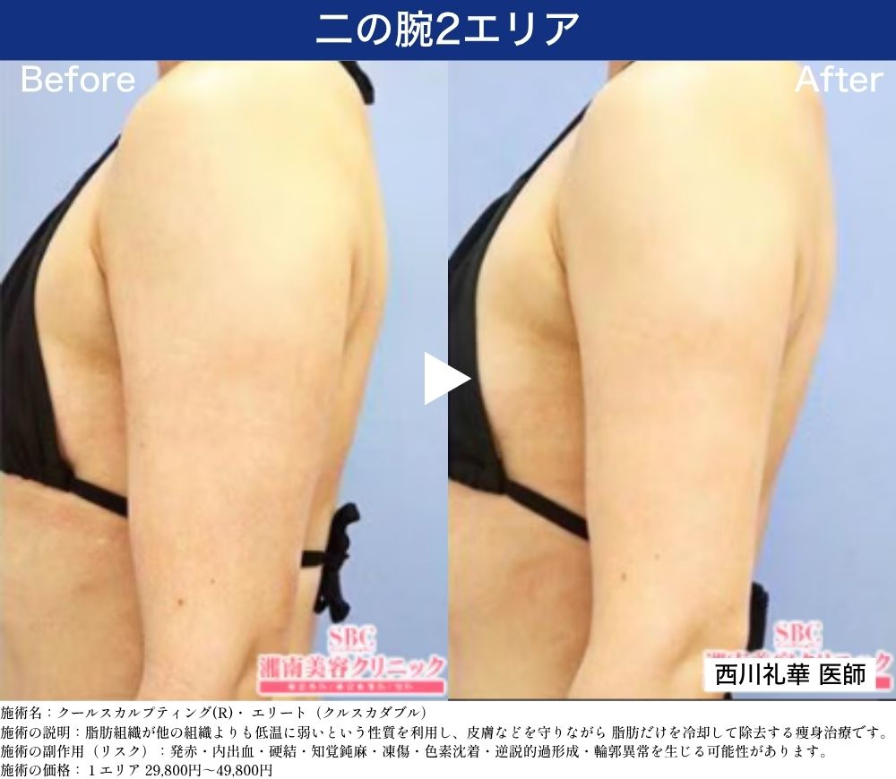 公式】福岡・小倉で医療ダイエット｜湘南美容のクルスカ(脂肪冷却)で