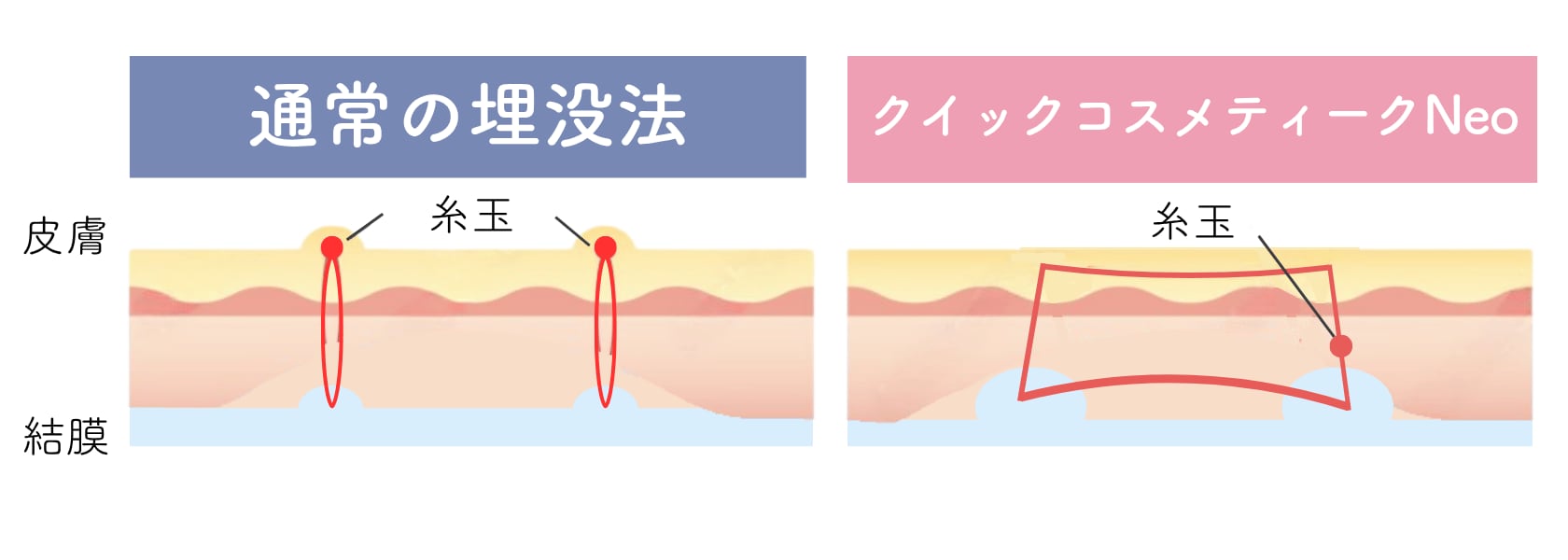 人気の理由とは？