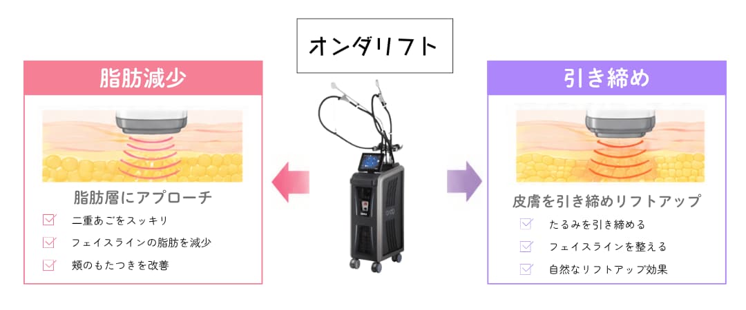 「オンダリフト」は小顔治療のいいとこどり