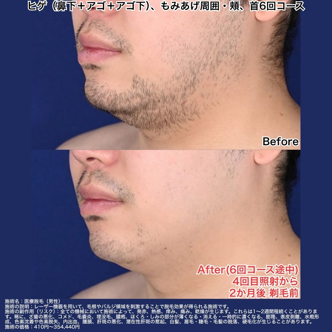 〜清潔感と自信を手に入れる〜