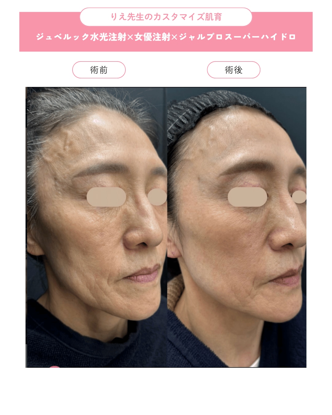 3つの肌育施術を組み合わせて、理想の肌へ