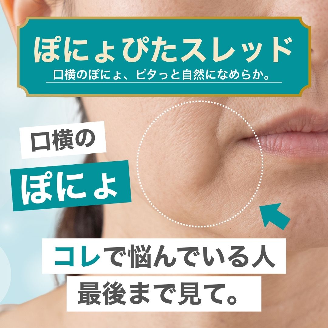 口横の「ぽにょ」に糸リフトは効果なし？後悔しない「ぽにょぴたスレッド」徹底解説【湘南美容クリニック小倉院】