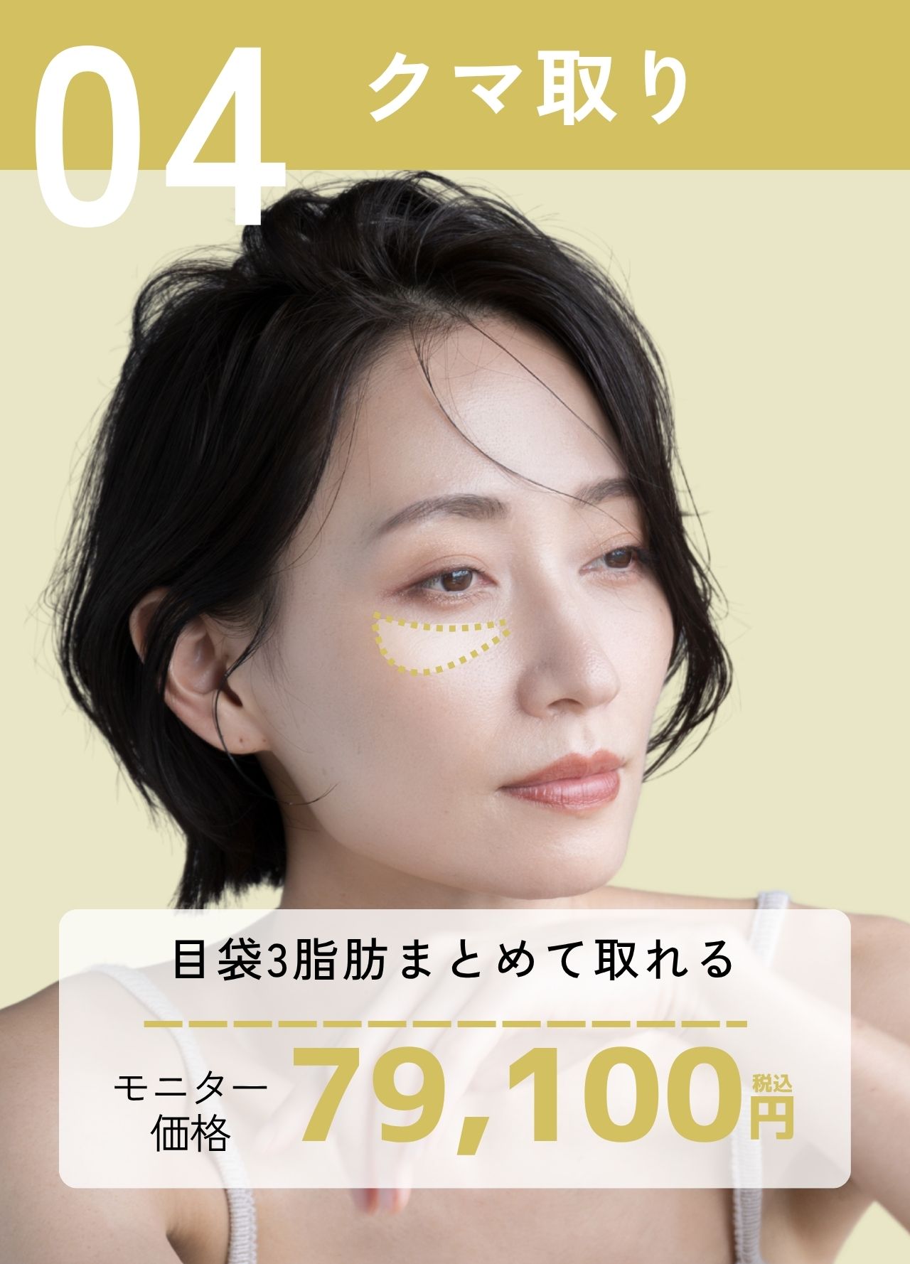 【疲れ顔改善】目袋3脂肪を適切量しっかり取れます！