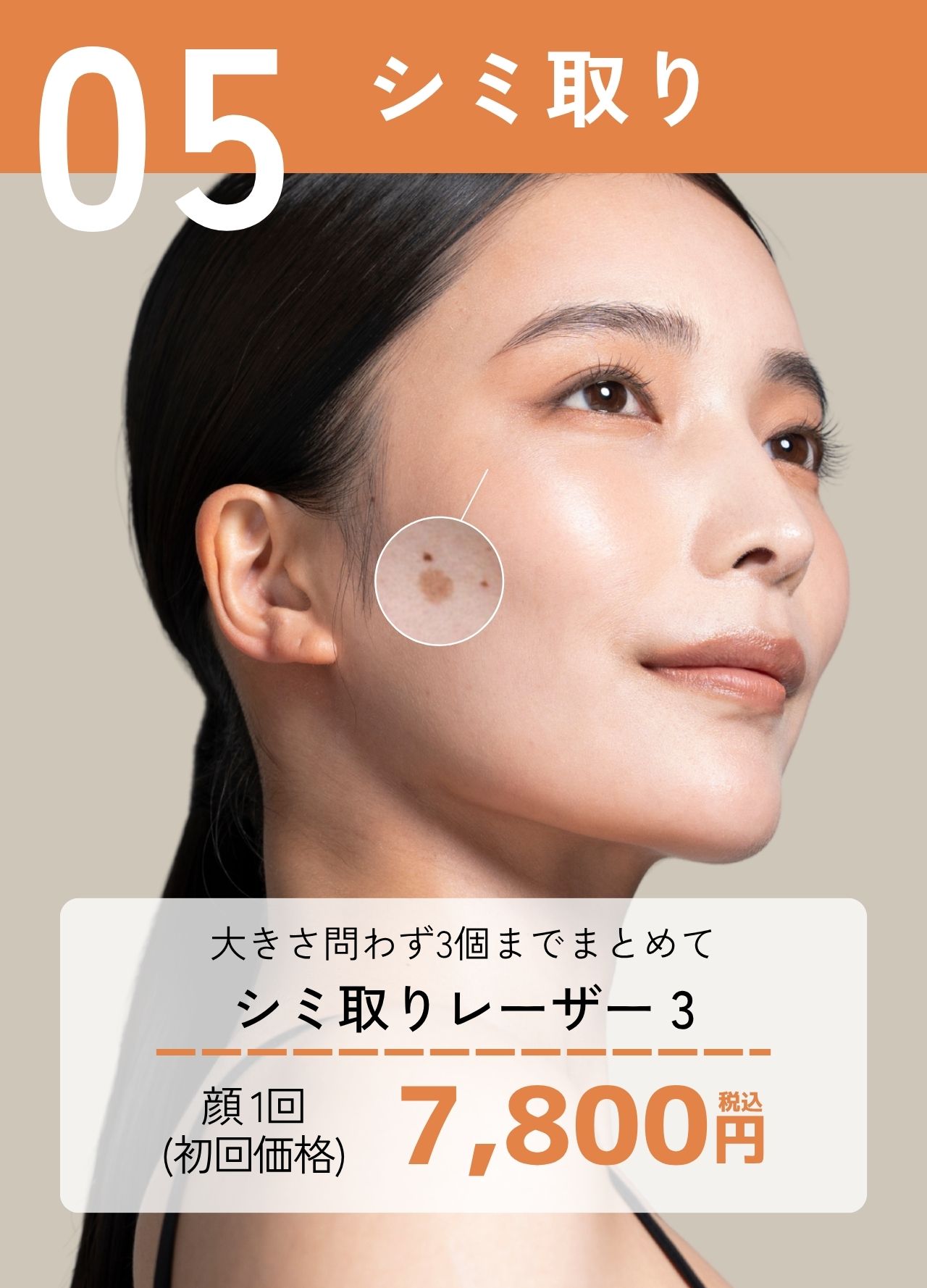 【湘南の選べるシミ取り】ピンポイント照射で気になるシミを除去！