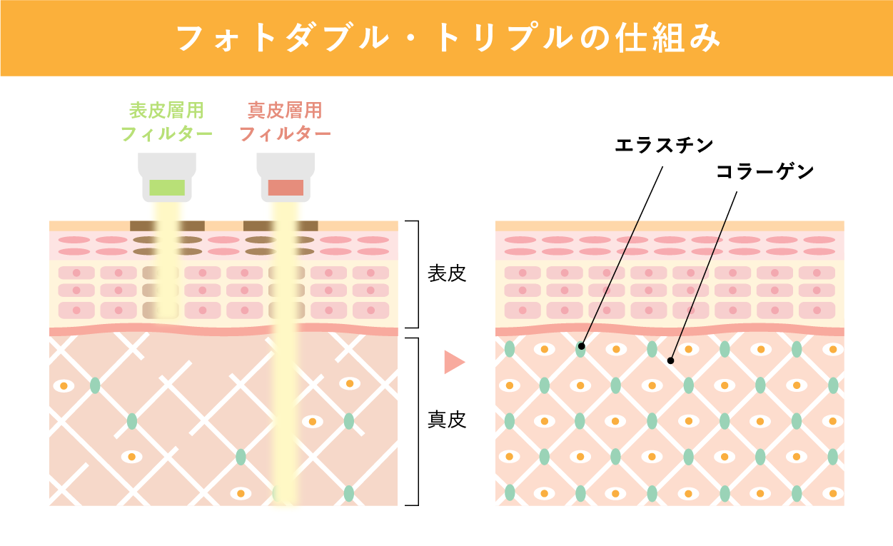 フォトダブル・トリプル