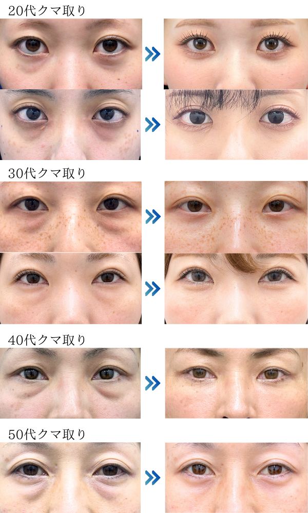 まずは年齢別の症例をご覧ください