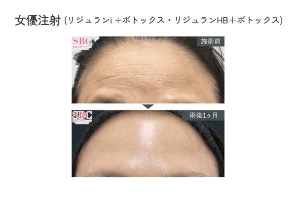 小じわや毛穴を改善し、マット肌・ツヤ肌に✨