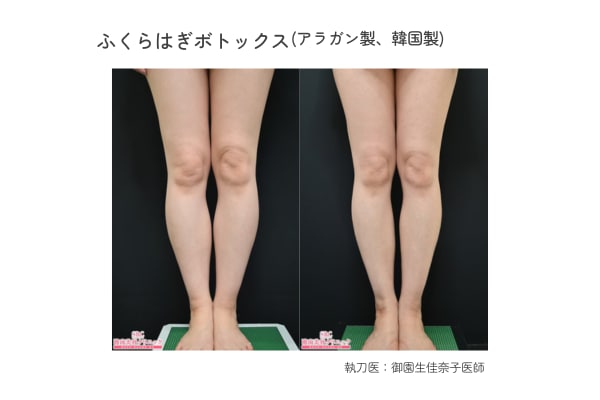 ふくらはぎ痩せしたい方必見です❗️