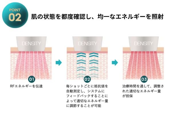 肌の状態を都度確認し、均一なエネルギーを照射