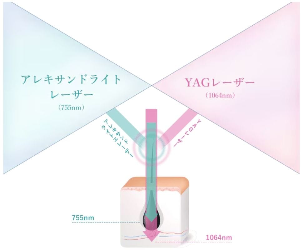 どんな脱毛器？