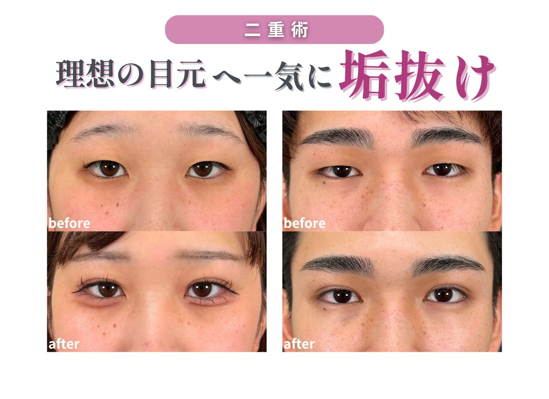 たった30分で理想の目元に👀✨