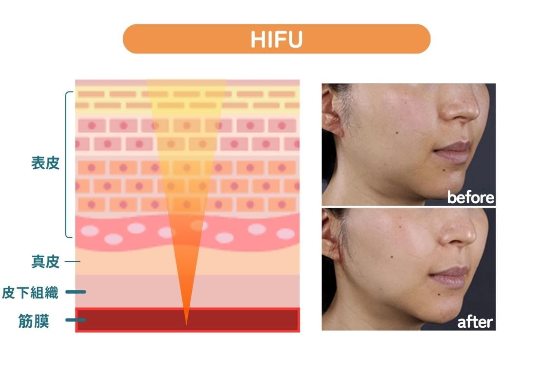 お肌の土台から整え引き上げる！