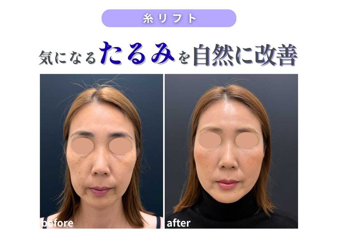 自然なのに綺麗に🪡