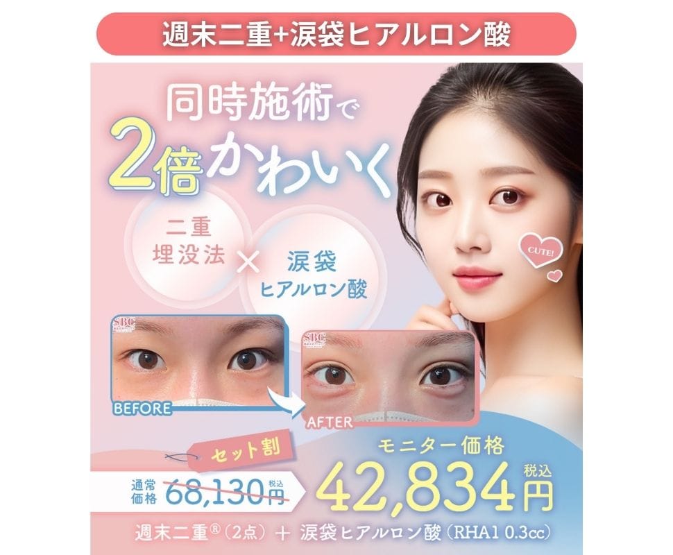 週末二重+涙袋ヒアルロン酸のセットメニューが、とってもお得なキャンペーン価格でご案内♪
