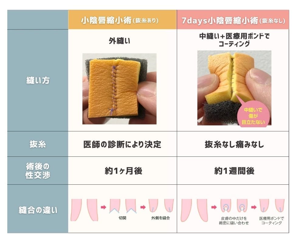 7days法ができるのは限られた医師のみ！