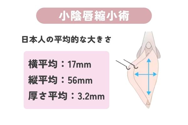 セルフチェックが難しい方はお気軽に相談ください♪
