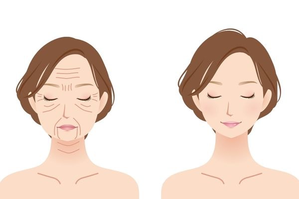 たるんでいる人はリガメントが緩んでいるのかも