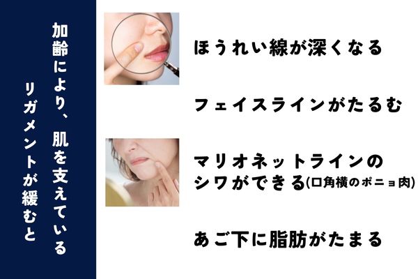 肌を支えているリガメントが緩むと...