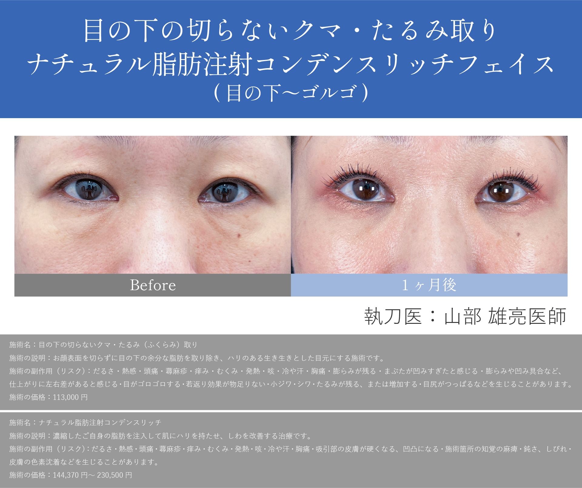 40代女性の症例写真と山部先生の解説