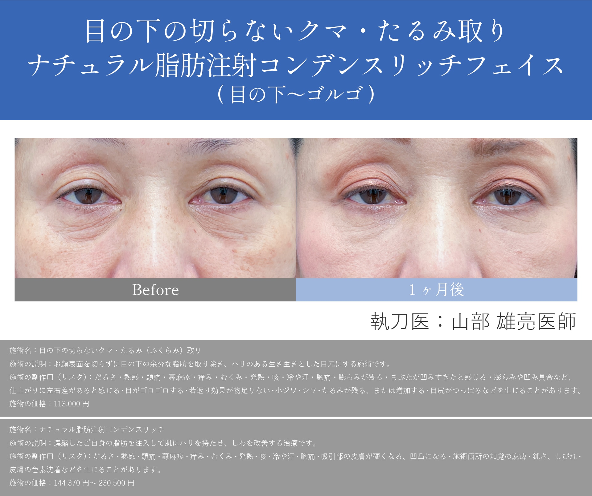 50代女性の症例写真と山部先生の解説