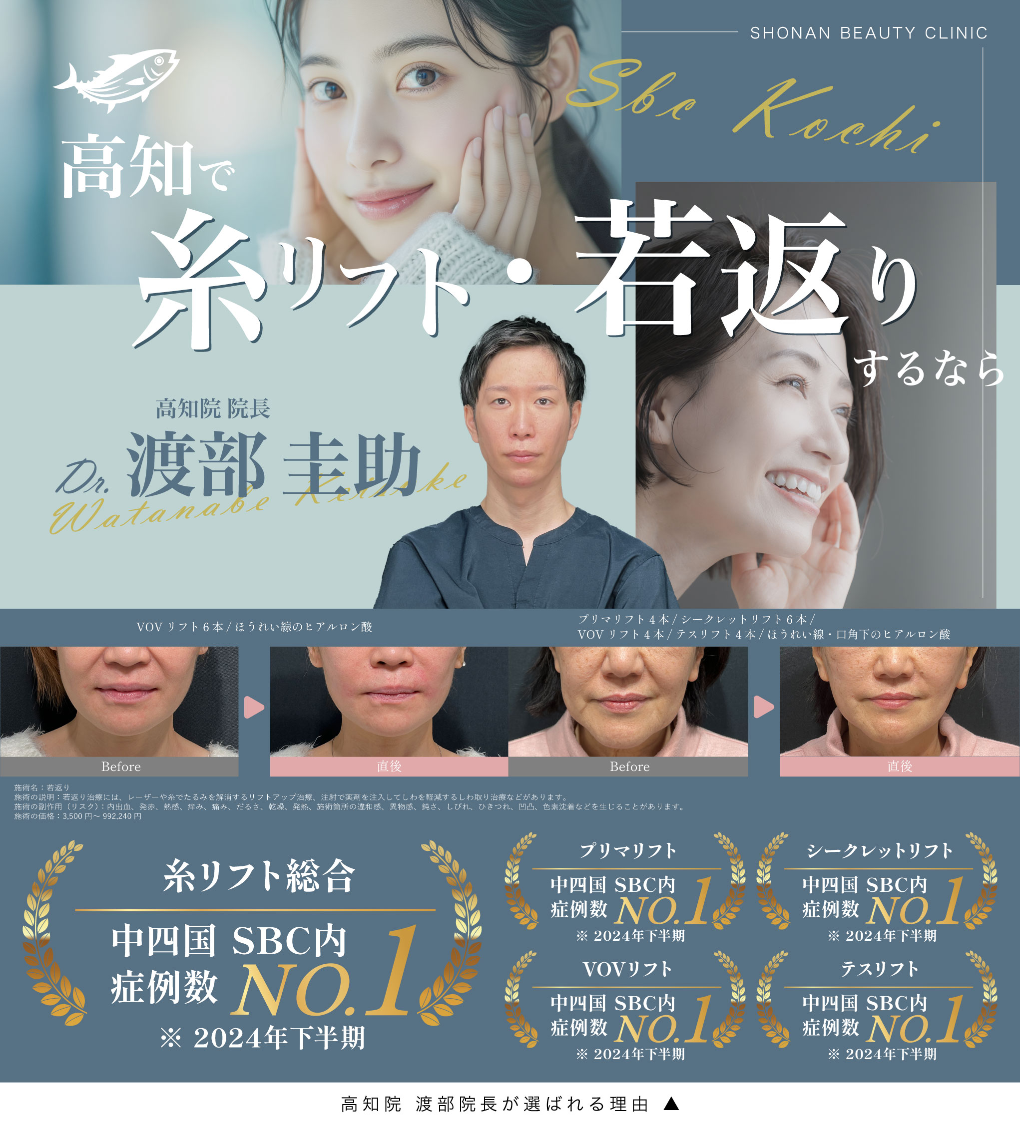 高知で糸リフト・若返りするなら渡部院長