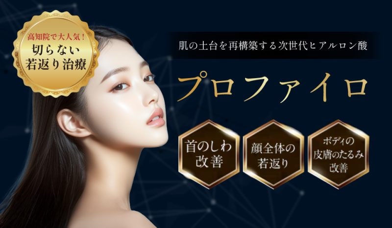 プロファイロとは