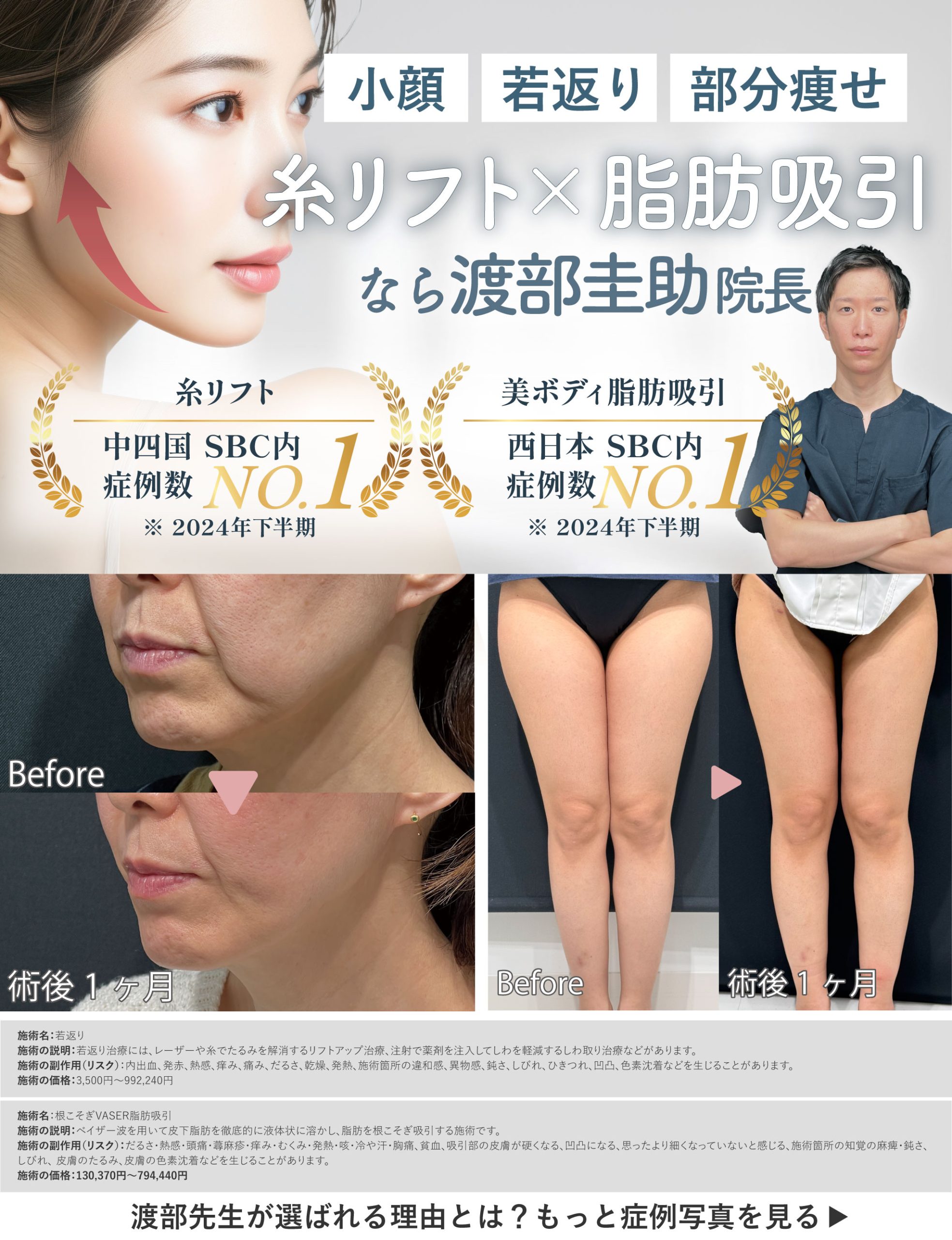 高知で糸リフト・脂肪吸引するなら渡部院長