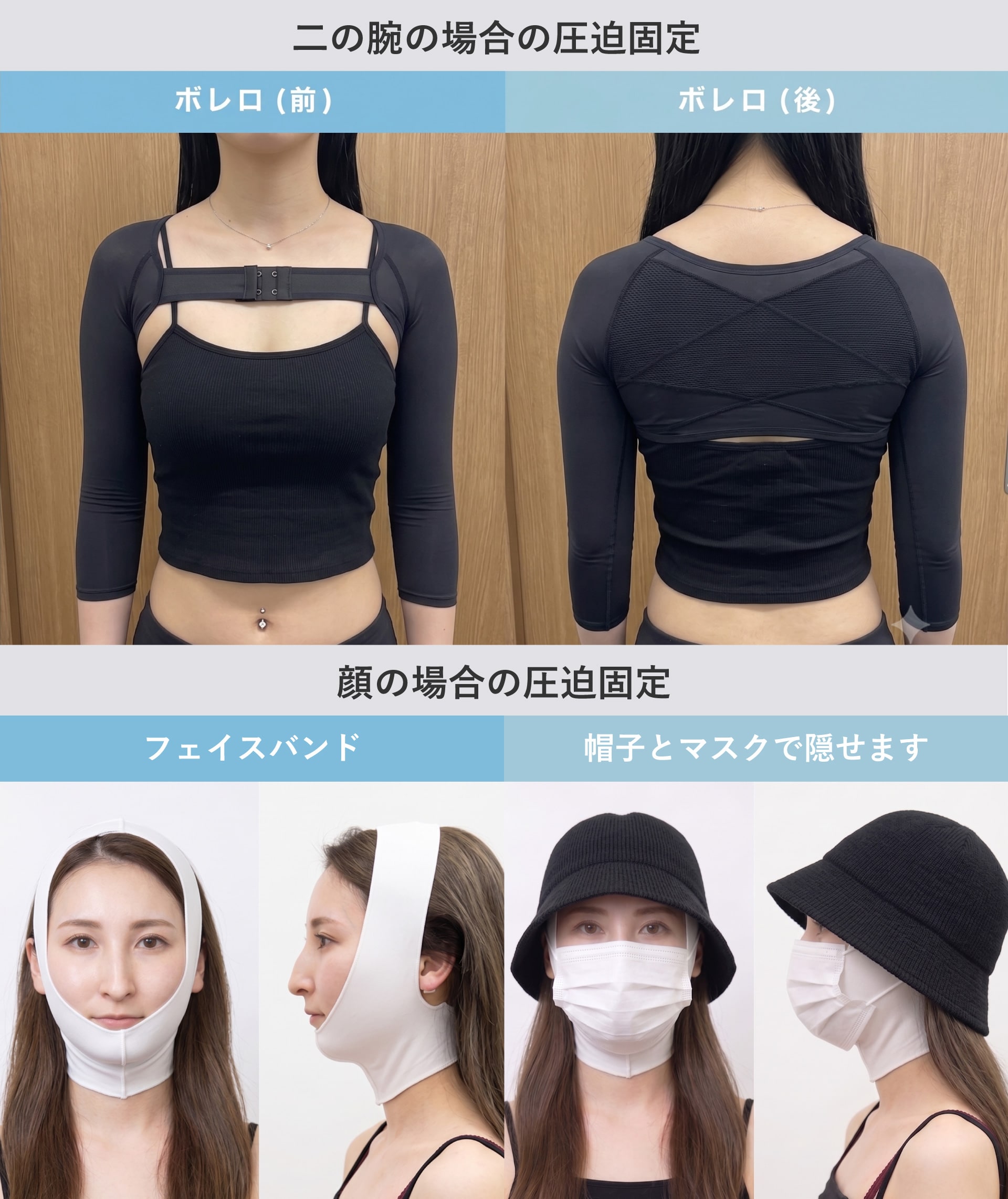 圧迫固定について