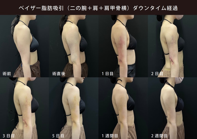 ダウンタイムの詳細
