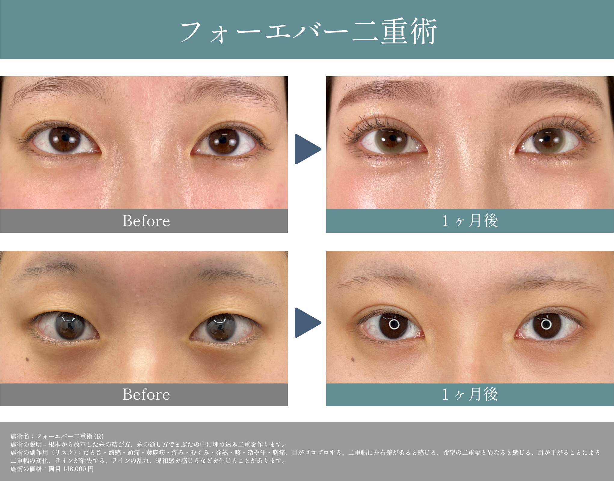 二重術の症例写真