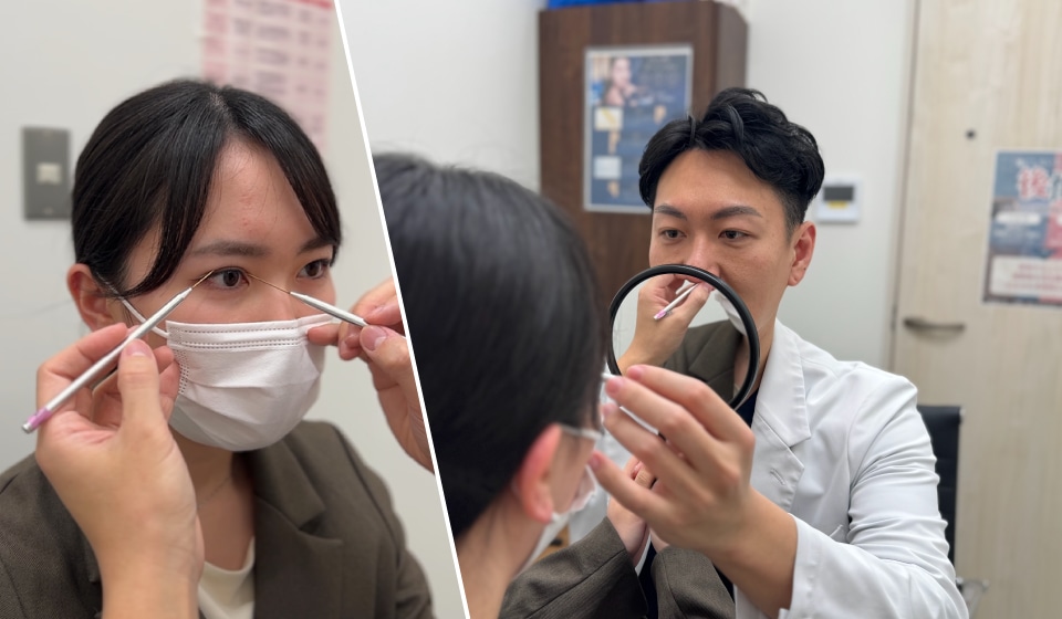 納得いくまで何度でも、山部医師がこだわる二重シミュレーションとデザイン提案
