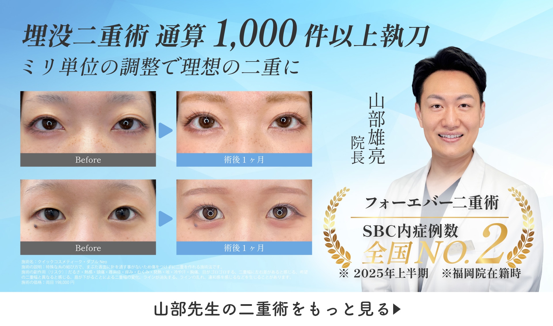 山部先生の二重術をもっと見る