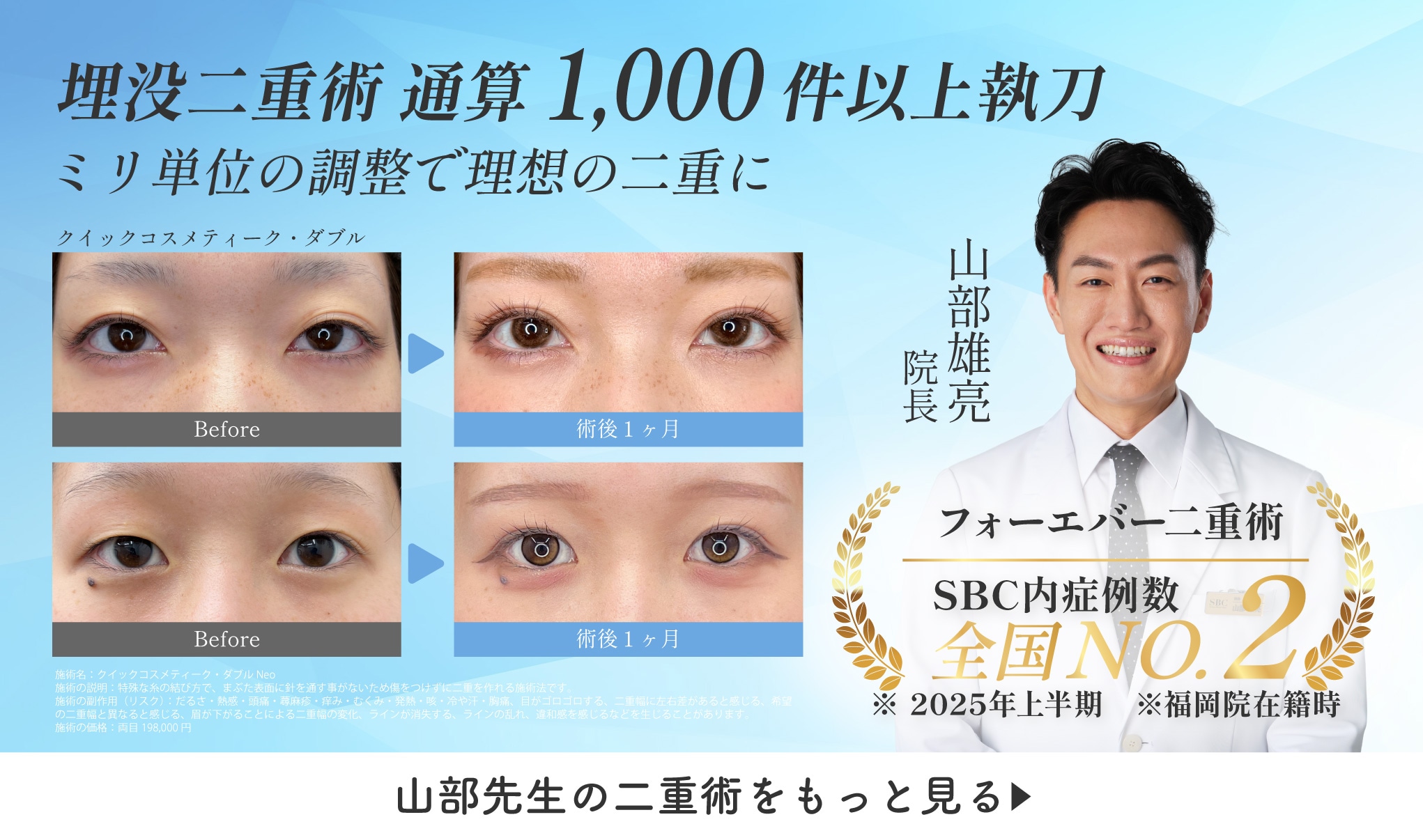 山部先生の二重術をもっと見る